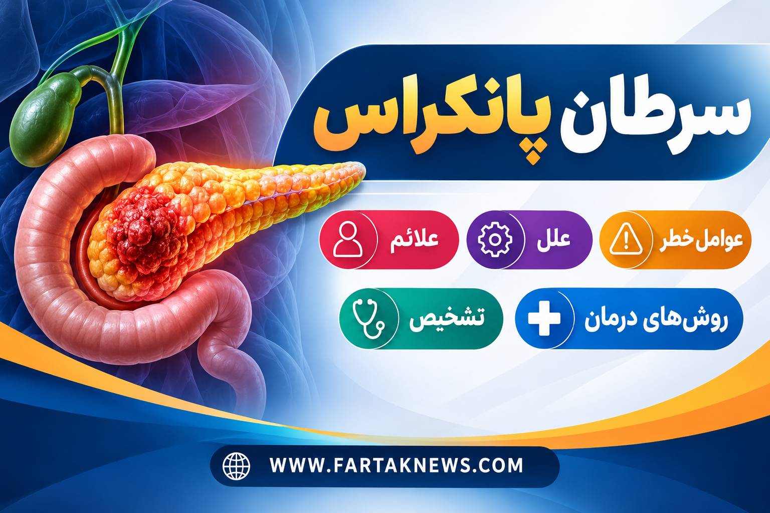 سرطان پانکراس