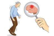 آنچه باید در مورد پارکینسون بدانید!