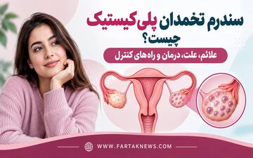 سندرم تخمدان پلی‌کیستیک چیست؟ علائم، علت، درمان و راه‌های کنترل