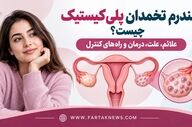 سندرم تخمدان پلی‌کیستیک چیست؟ علائم، علت، درمان و راه‌های کنترل
