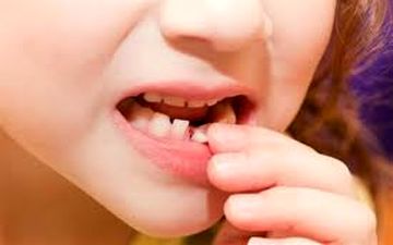 دندان های کودکانتان را حتما بررسی کنید!