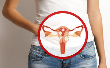 فیبروم رحمی چیست؟ همه چیز درباره توده‌های خوش‌خیم رحمی