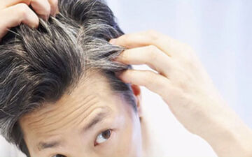 کمبود این ویتامین ها و مواد معدنی باعث سفید شدن زودرس مو می شود