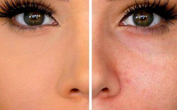 منافذ پوست را چگونه تمیز کنیم ؟ / نکات و روش های عالی باز کردن منافذ پوستی 