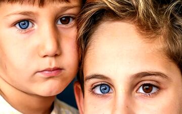 نادرترین رنگ‌های چشم و رمز آن‌ها!