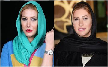 چهره باورنکردنی و زشت فریبا نادری قبل از عمل جراحی + عکس