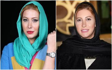 چهره باورنکردنی و زشت فریبا نادری قبل از عمل جراحی + عکس