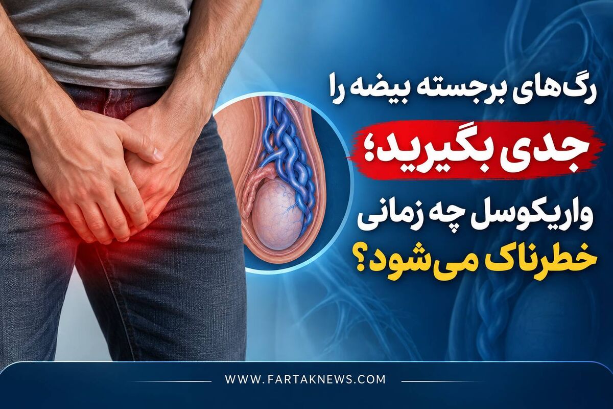 رگ‌های برجسته بیضه را جدی بگیرید؛ واریکوسل چه زمانی خطرناک می‌شود؟