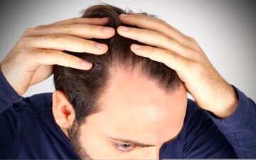 غذاهایی که ممکن است ریزش مو را تشدید کند
