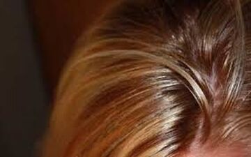 دلایل چرب شدن موی سر و راههای کاهش آن