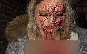 این دختر برای فرار از دام مرد شیطان صفت تا حد مرگ کتک خورد!!