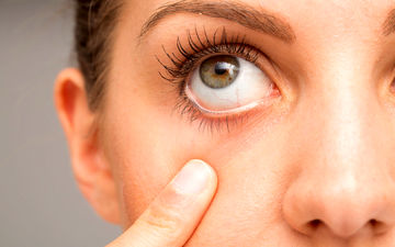 برای خشکی چشم باید به پزشک مراجعه کنید؟