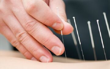 طب سوزنی کدام بیماری ها را درمان می کند؟
