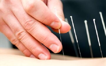 طب سوزنی کدام بیماری ها را درمان می کند؟
