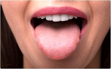 زبان شما می تواند وضعیت احساسات و سلامت شما را آشکار کند