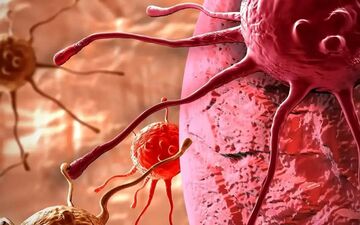 چگونه با رژیم غذایی خطر ابتلا به سرطان سینه را کاهش دهیم؟