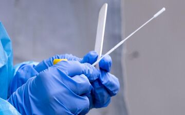 
جواب تست PCR قابل اطمینان است؟