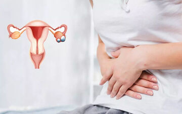 ترکیدن کیست تخمدان چه علائمی دارد؟