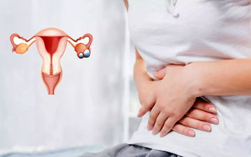 ترکیدن کیست تخمدان چه علائمی دارد؟