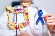 هشداری که باید جدی گرفته شود: علائم اولیه سرطان روده بزرگ در جوانان چیست؟