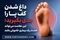 داغ شدن کف پا نشانه چیست؟ از کمبود ویتامین تا بیماری‌های عصبی؛ چه زمانی باید نگران شد؟