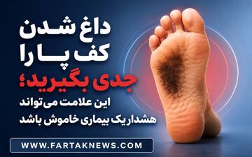 داغ شدن کف پا نشانه چیست؟ از کمبود ویتامین تا بیماری‌های عصبی؛ چه زمانی باید نگران شد؟