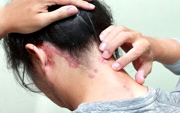این علائم در موقع خواب نشان دهنده بیماری قلبی است! 