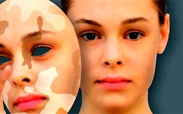 ویتیلیگو چیست و گریبانگیر چه کسانی می‌شود؟