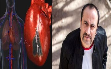  چگونه سکسکه باعث مرگ «عارف لرستانی» شد؟
