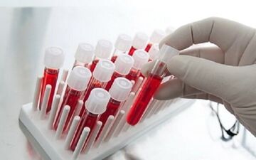 بازگشت پالایشگاه خون به دولت پس از ۱۰ سال