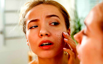 برای داشتن پوستی سالم و درخشان در فصل سرما چکار کنیم؟