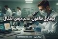 بیماری طاعون: علائم، درمان و راه‌های انتقال