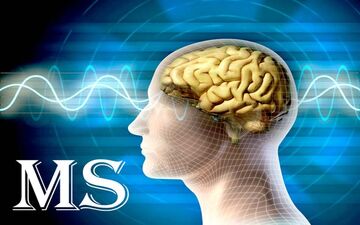 تاثیر بیماری ام اس بر بینایی