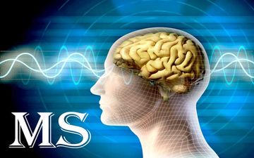 تاثیر بیماری ام اس بر بینایی
