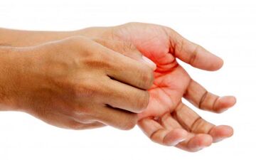 چرا کف دستمان میخارد؟