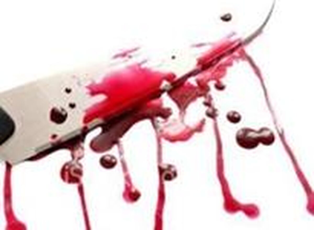  شبیه نبودن نوزاد به پدر دردسرساز شد؛ مرد پوست صورت همسرش را با چاقو کند 