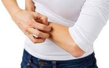 دلایل بروز خارش پوست|علائم خارش پوست چیست؟