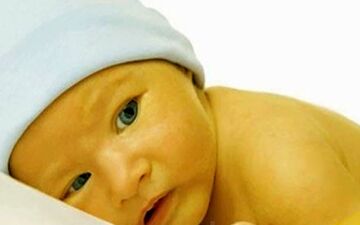 باورهای غلط درباره زردی، جان نوزاد را به خطر می‌اندازد