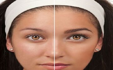 روش‌های ترمیم ابرو برای زیبایی و ماندگاری بالاتر