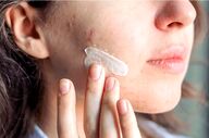 از بین بردن لک صورت با خمیر دندان؛ واقعیت یا یک باور غلط؟