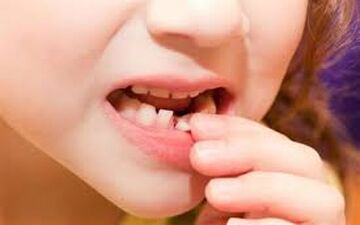 اهمیت مراقبت از دندان‌های شیری !