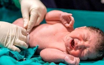 کدام زایمان عوارضش کمتر است؟