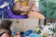 نجات نوزاد ۲ماهه با پارگی طحال در سمنان