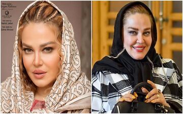چهره عجیب و باورنکردنی بهاره رهنما بعد از عمل جراحی / بهاره 18 ساله شد + عکس