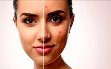 خودارضایی بر چهره تاثیر می گذارد؟