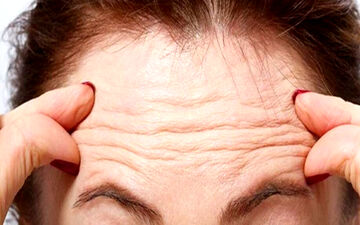 چین و چروک پوست چگونه ایجاد می‌شود؟
