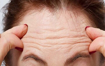 چین و چروک پوست چگونه ایجاد می‌شود؟