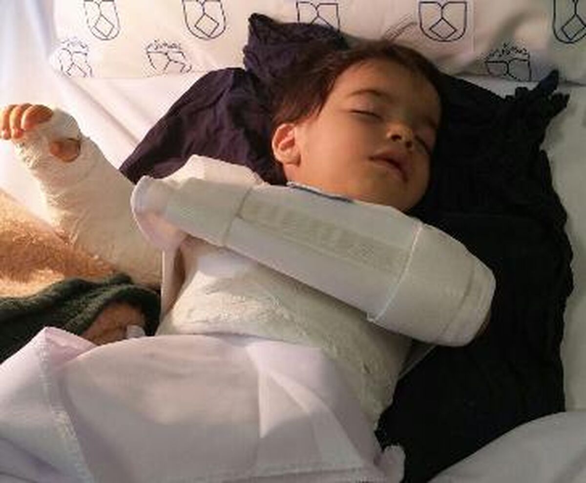 دست چپ کودک 2 ساله به جای راست جراحی شد