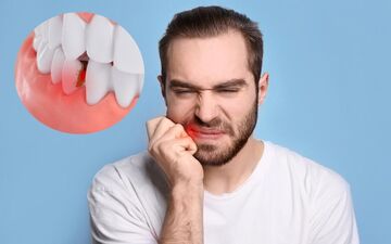 چرا مردان بیشتر از زنان به بیماری‌های دهان و دندان مبتلا می‌شوند؟