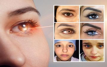 تب تبلیغاتی در اینستاگرام: جراحی تغییر رنگ چشم؛ از هزینه‌های میلیونی تا نابینایی